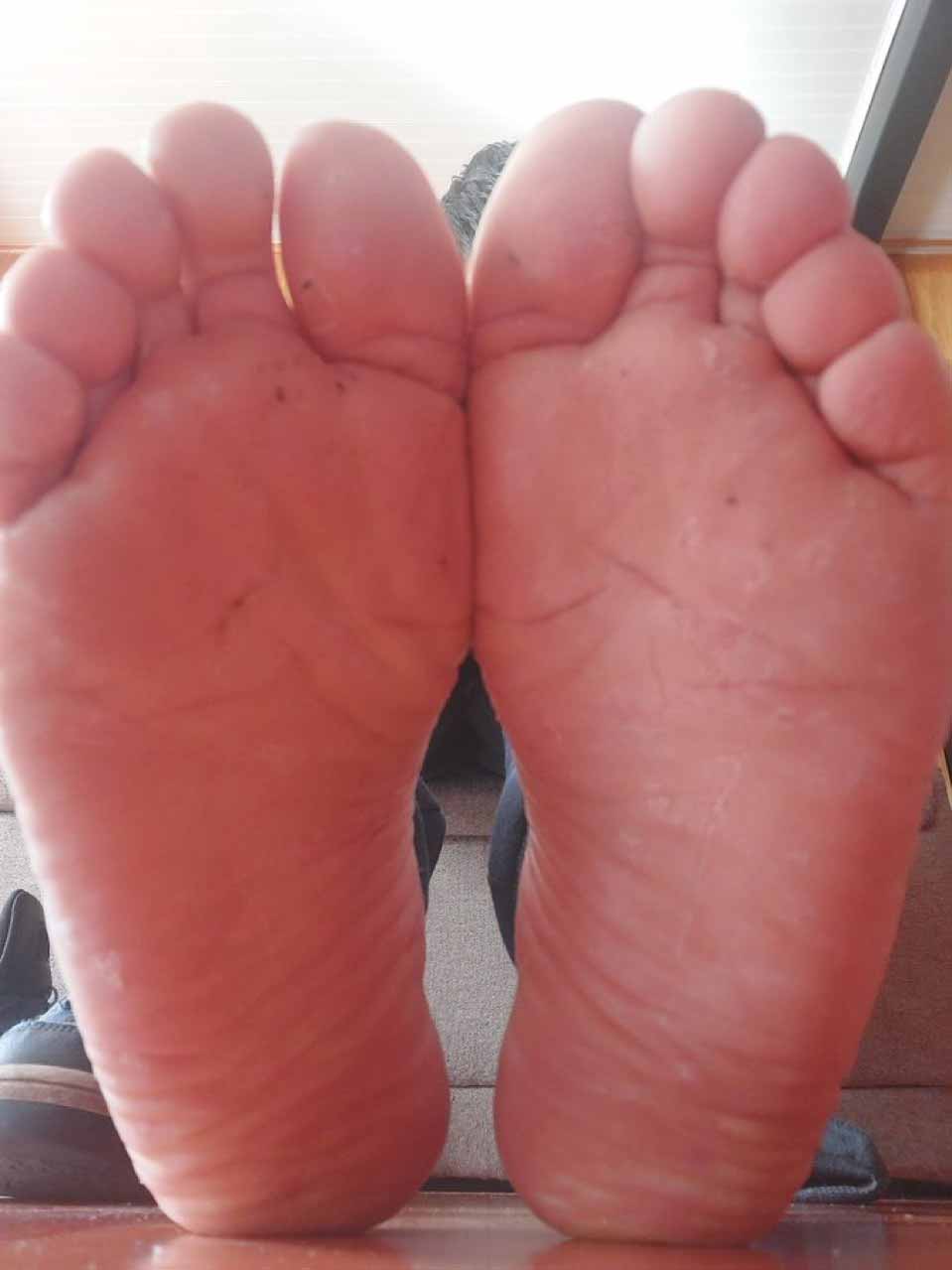 Look these huge grampa toes