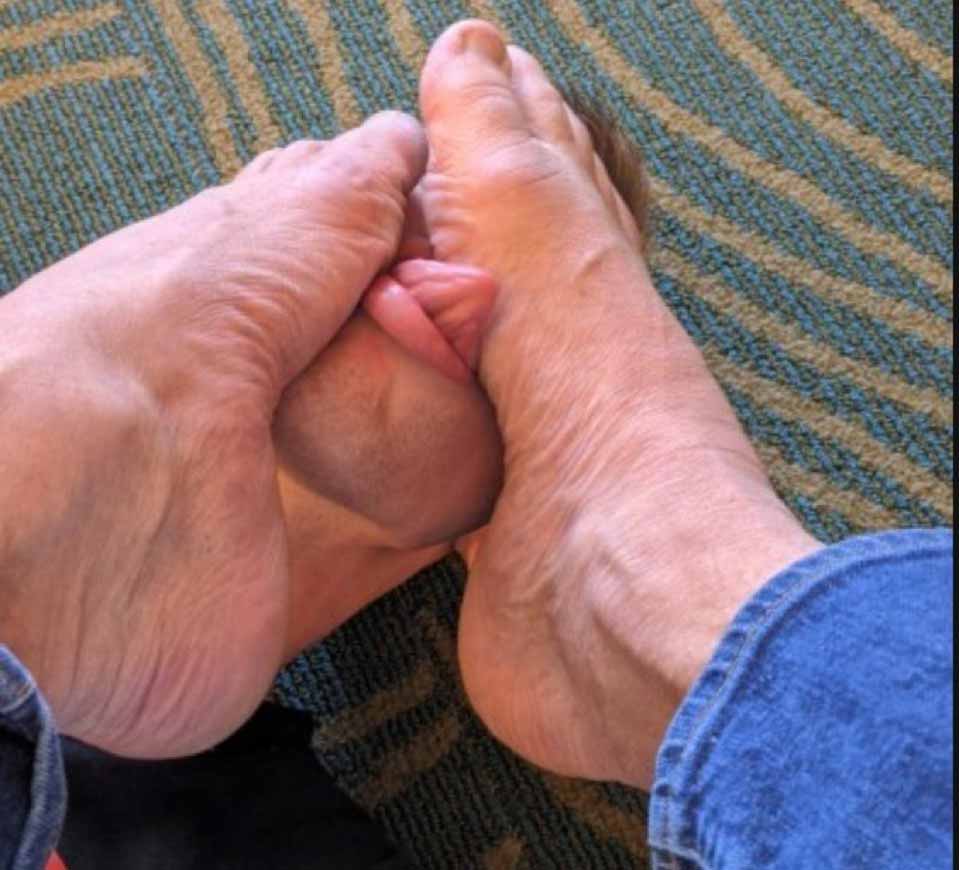 Look these huge married toes